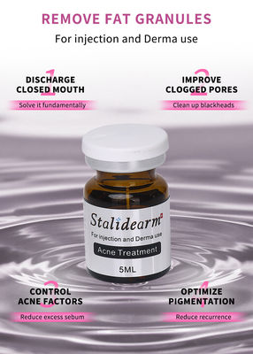 Stalidearm Dermal Fillers รักษาสิว สารสับฉีดเพื่อรักษาสิวและลดจุดบกพร่อง