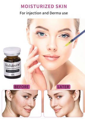 Stalidearm Hyaluronic Acid Injectable Face Serum สําหรับการกระตุ้นผิวหนังและการรักษาผิว