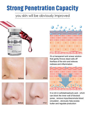 ชุดเซรั่มบำรุงผิวหน้าด้วยปากกา Exosome Dermal Pen เพื่อผิวขาวใส MESO สูตรหรูจากฝรั่งเศส