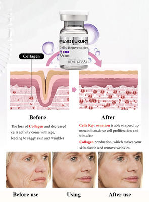 Meso Cell Rejuvenating Power Serum ต่อต้านวัย Microneedling สำหรับการฟอกสีผิว