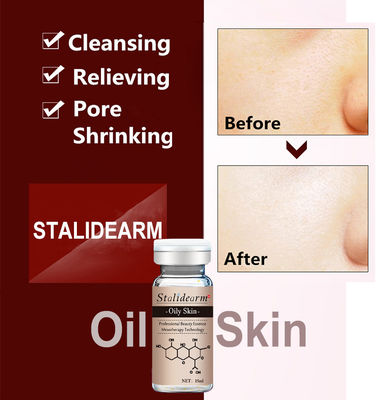 เซรั่มสมุนไพรออร์แกนิกต่อต้านสิวฉลากที่กำหนดเอง Dermapen Face Essence สำหรับผิวมัน