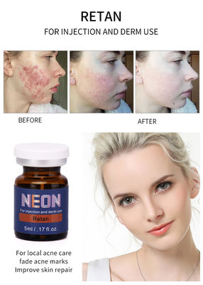 Neon Meso Therapy Serum ฉีด 5ml เซรั่มรักษาสิว Pure Essence