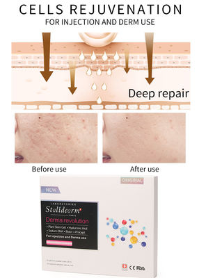 Cells Rejuvenation Youth Serum ฉีด Stalidearm 5ml Skin Care Injection