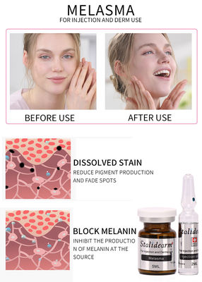 ฉีดฝ้า ใช้เซรั่ม Mesotherapy ปลอดภัยและได้ผลดี 5ml/ขวด ชุดเซรั่ม