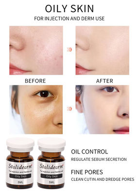 เซรั่มฉีดสำหรับผิวมัน 5ml/ขวด Safe Good Effect Essence Set Original Stalidearm Brand