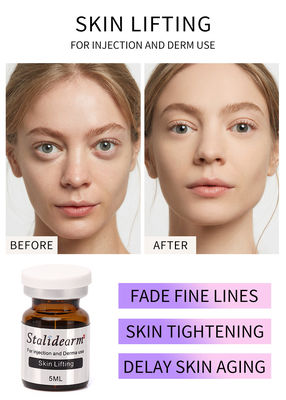 Stalideram Anti Aging Skin Lifting Injection Serum หัวฉีด Skin Care PRP เอฟเฟกต์ธรรมชาติ